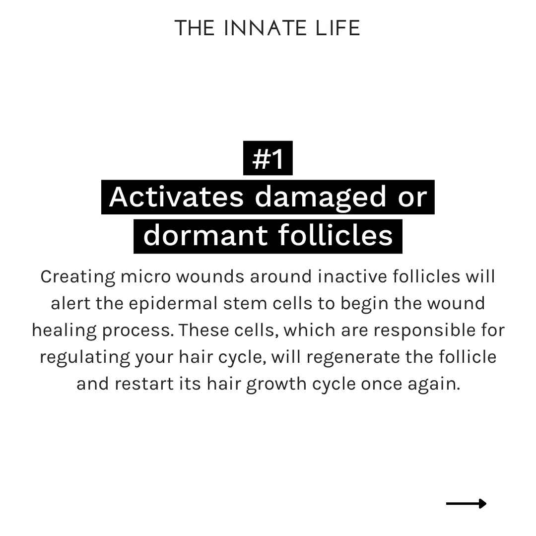DERMA ROLLER
